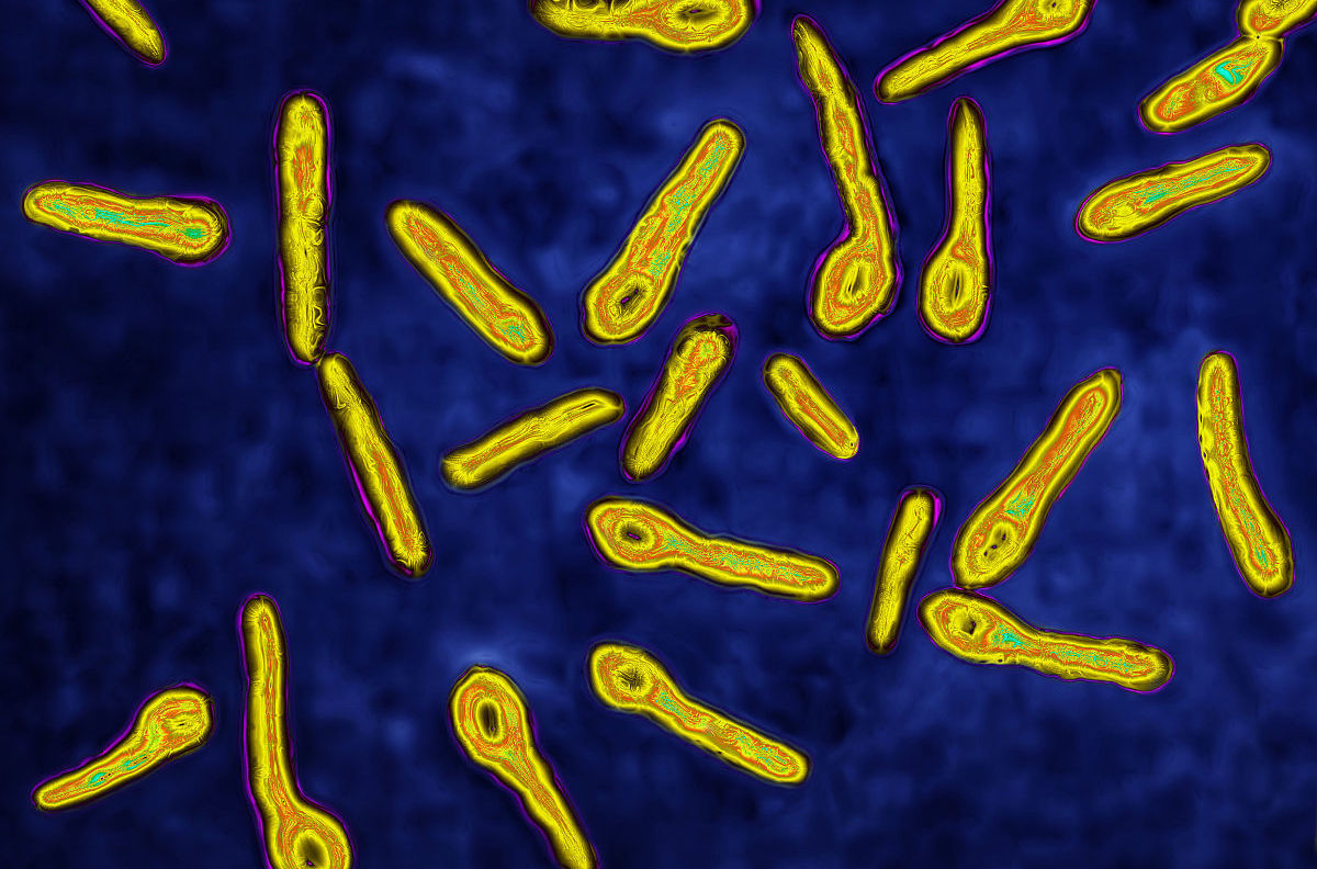 竹签刺破了手指要不要打破伤风针,竹签刺到会得破伤风吗