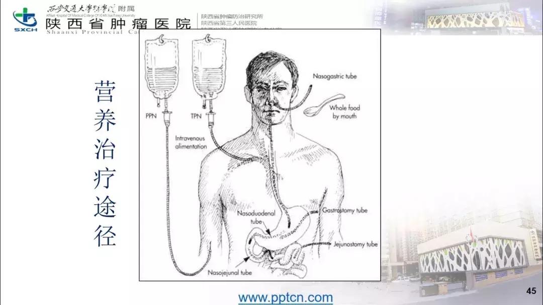 肿瘤营养治疗案例分享,肿瘤营养治疗最新进展