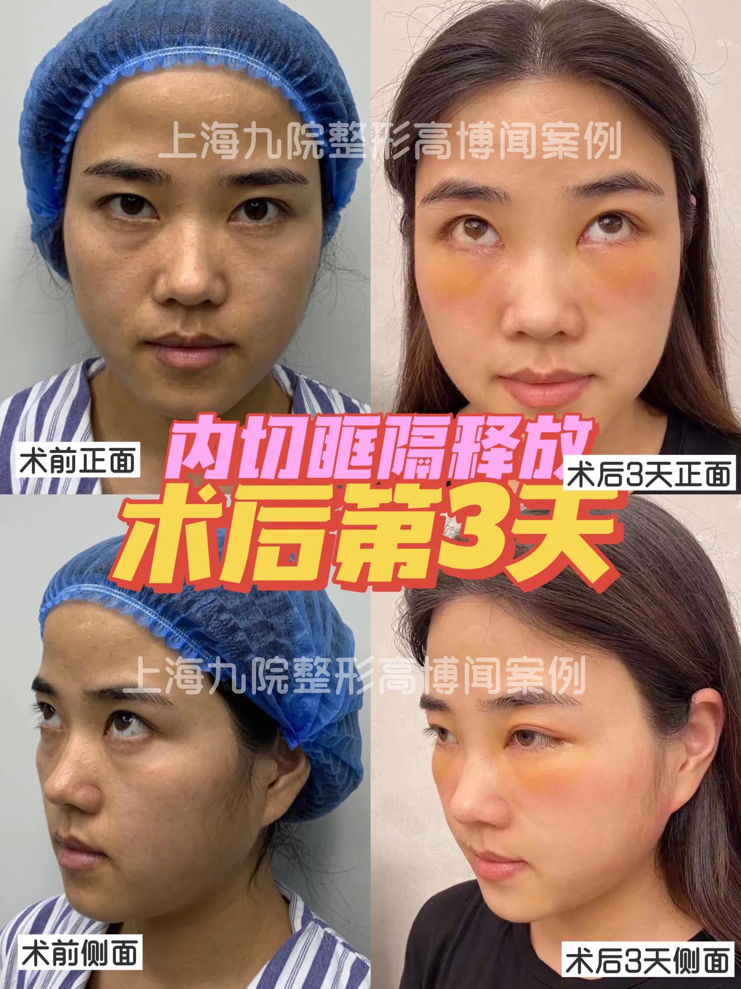 <html>
<head><title>502BadGateway</title></head>
<body>
<center><h1>502BadGateway</h1></center>
<hr><center>nginx</center>
</body>
</html>
<!--apaddingtodisableMSIEandChromefriendlyerrorpage-->
<!--apaddingtodisableMSIEandChromefriendlyerrorpage-->
<!--apaddingtodisableMSIEandChromefriendlyerrorpage-->
<!--apaddingtodisableMSIEandChromefriendlyerrorpage-->
<!--apaddingtodisableMSIEandChromefriendlyerrorpage-->
<!--apaddingtodisableMSIEandChromefriendlyerrorpage-->
