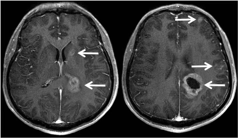绁炶嵂鍥戒骇,鑽鎵撴灦鐗囨