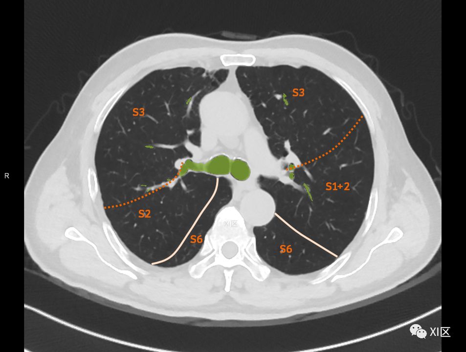 如此详细的肺部影像解剖，有点儿酷！