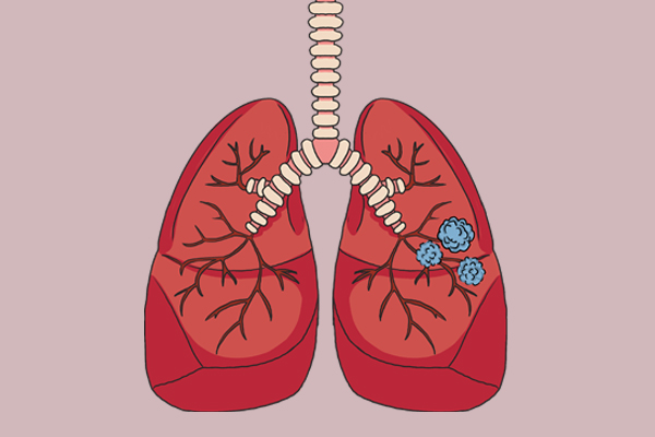 给大家推荐一款戒烟神器,世界上最厉害的戒烟神器