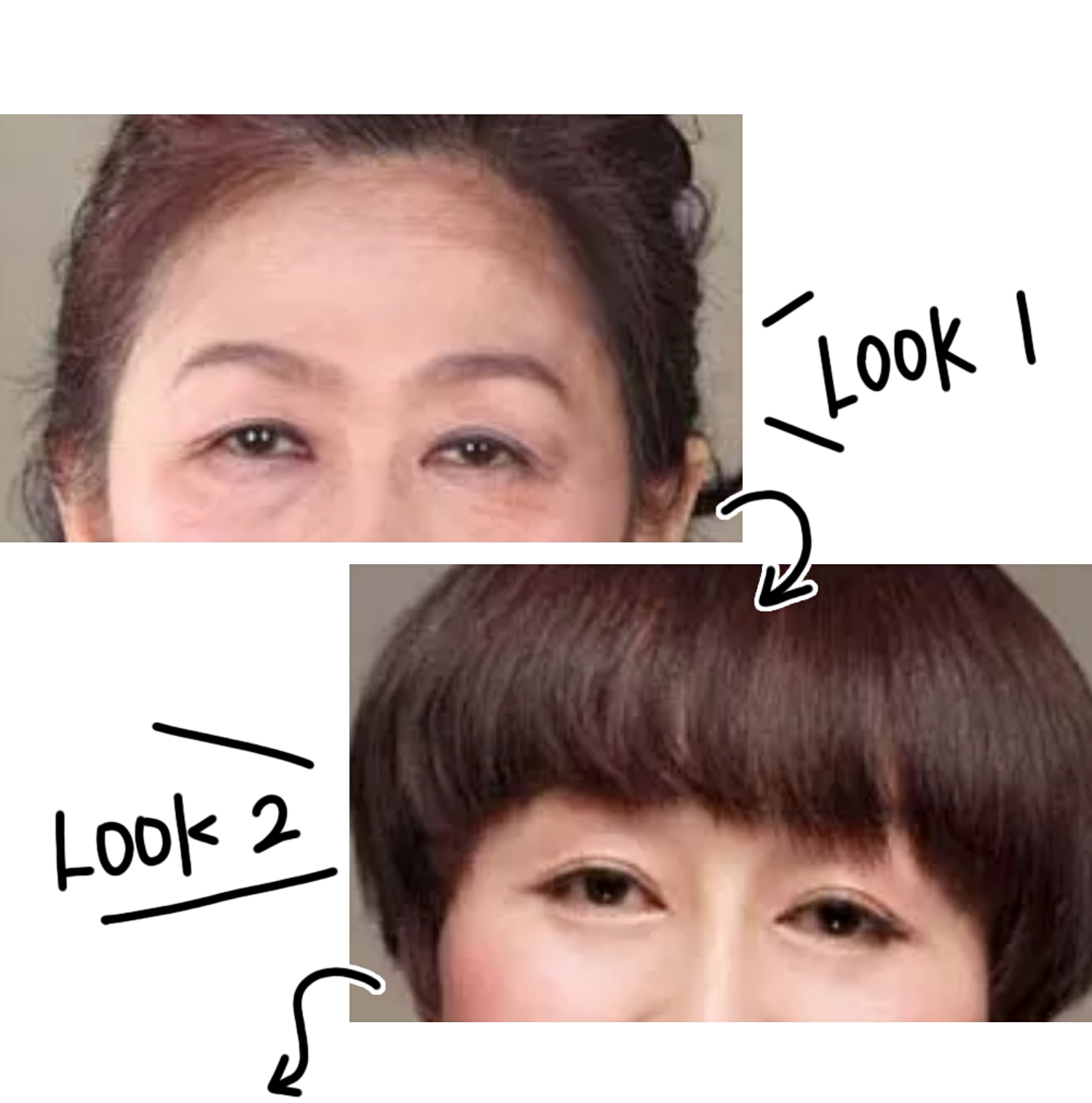 鱼尾纹眼袋怎么去除最有效,去除眼袋鱼尾纹最快最好的方法