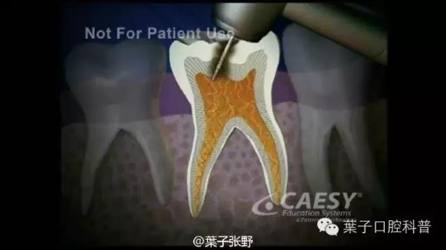 牙龈反复鼓包流脓是牙齿坏了吗,一上火牙龈就鼓包