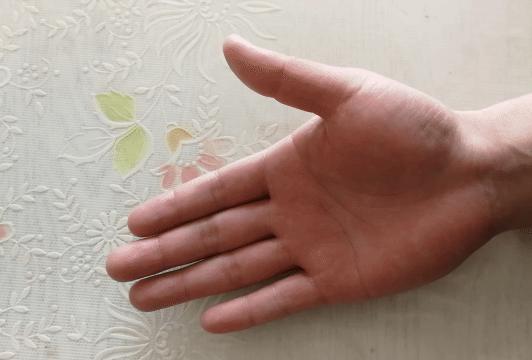 中年人患腱鞘炎怎么治,中老年腱鞘炎特效药