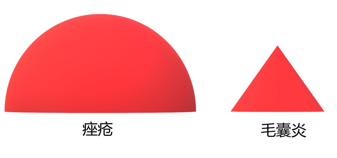 痘痘肌用什么护肤品效果最好男士,男士痘痘肌痘印护肤推荐
