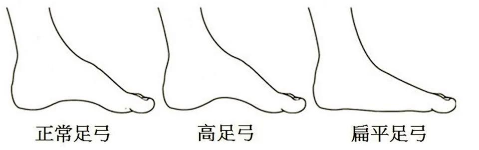 夏天穿凉鞋的季节，不懂脚型，选错鞋子又丑又磨脚！