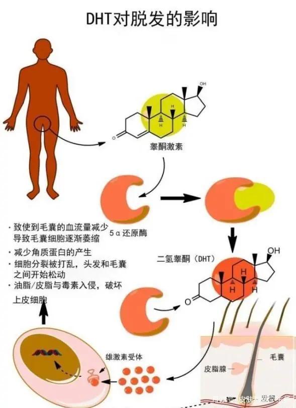 神秘的广谱药物,米诺地尔搽剂与非那雄胺生发区别