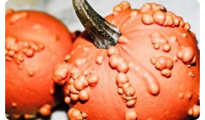 hpv阳性52导致宫颈癌的几率,由hpv引起的宫颈癌多吗