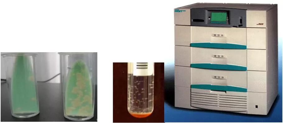 结核诊断方法和防治原则,结核的病原学诊断