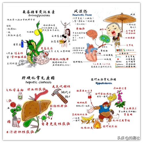 医学漫画视频|眼干、口干不是小事，小心干燥综合征
