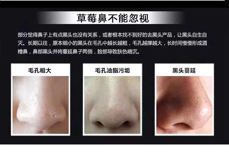 怎么解决糟心的黑头,怎么才能看清楚自己脸上的黑头