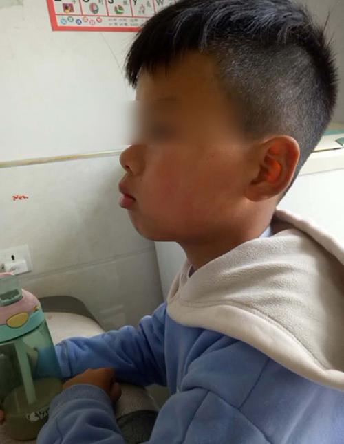 儿子长成“大嘴猴”,妈妈带去做检查,医生的话让她无地自容