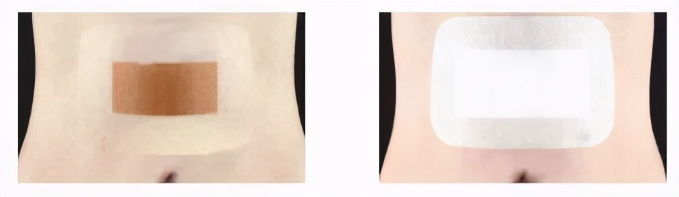 一篇文了解华卫壳聚糖敷料