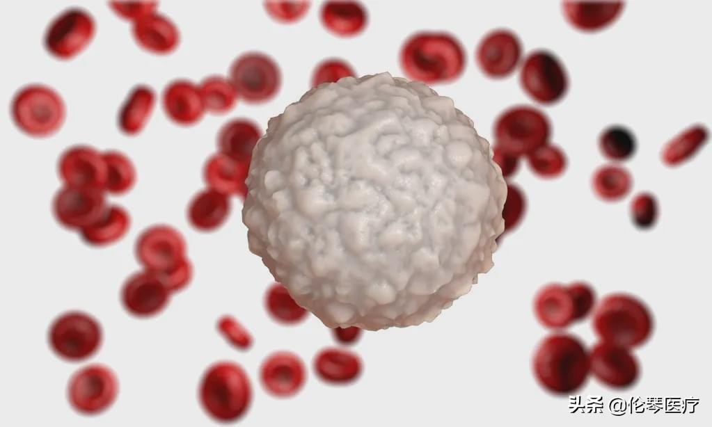 2022年恶性肿瘤筛查与预防指南,常见恶性肿瘤的预防和筛检