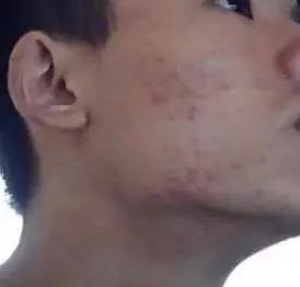 常见皮肤病的联合用药，呼吸道疾病的联合用药，值得收藏