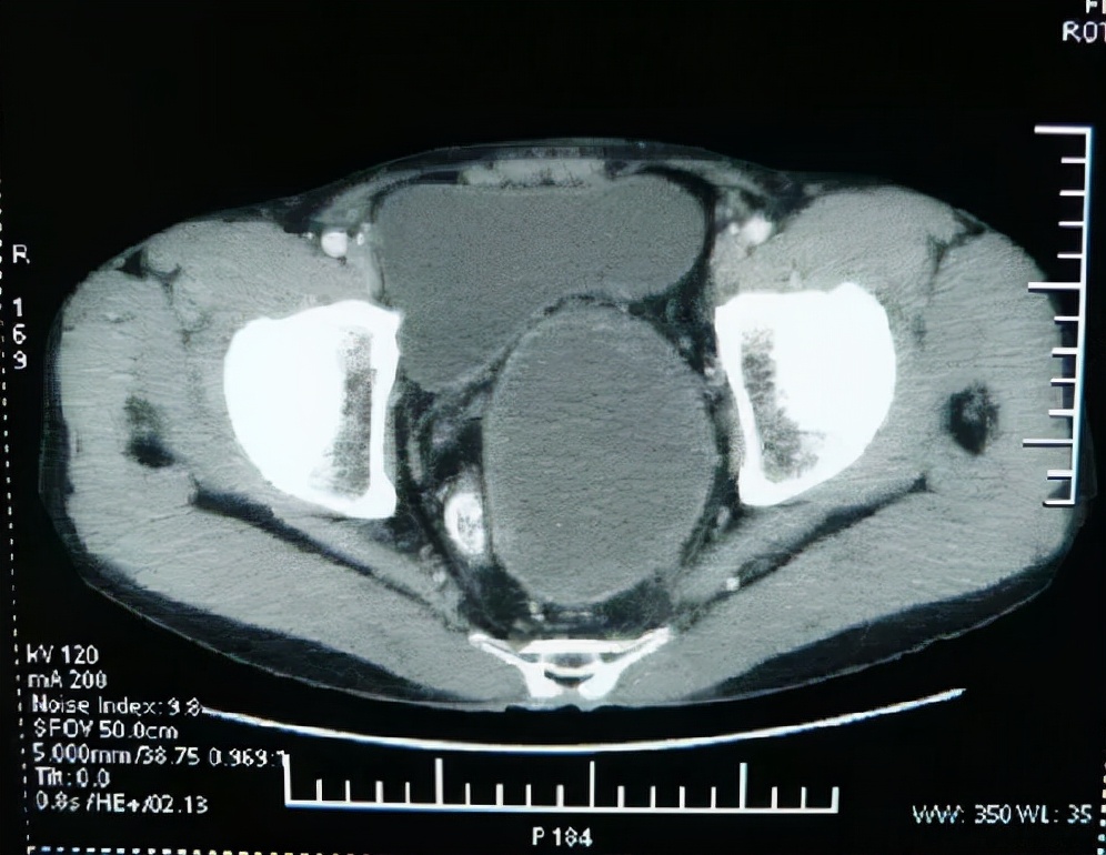 安军明针灸推拿,安军明针灸视频