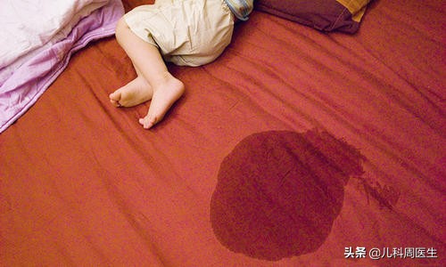 小孩爱尿床请问专家什么原因,孩子最近爱尿床是什么原因