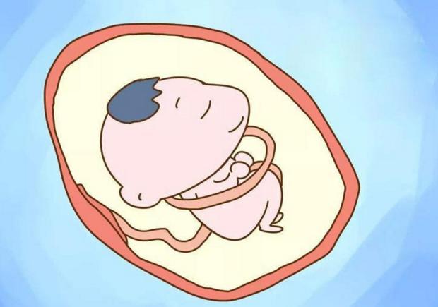 孕检胎儿绕颈一周怎么办,孕检胎儿绕颈会自动恢复吗