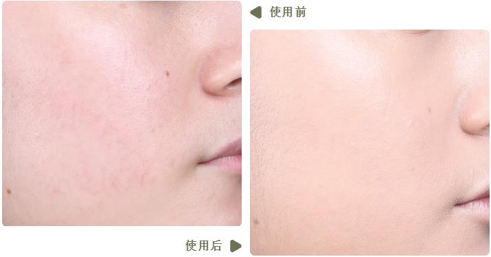 测大牌气垫,五款大热气垫真实测评