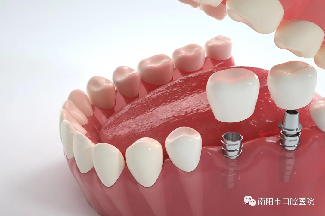 种植牙吃东西疼是怎么回事,种植牙疼吗大约多少钱一颗