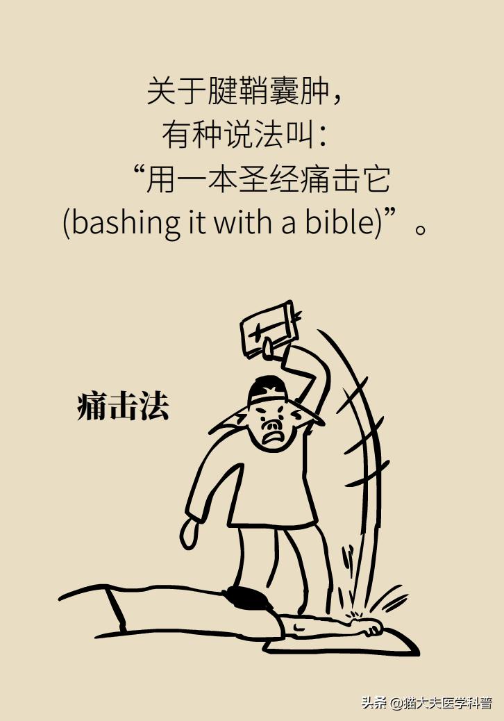 手腕长腱鞘囊肿,手腕上有个凸起的包腱鞘囊肿