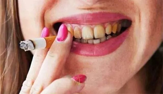 牙上有黑黑的东西，又丑又臭，给你2个解决方法