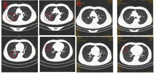 深圳第二人民医院疫情防控,深圳市第二人民医院抗疫情
