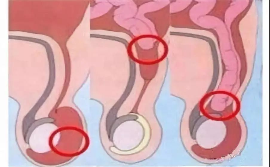 过敏宝宝吃营养包有危害吗,过敏宝宝营养包有必要吃吗