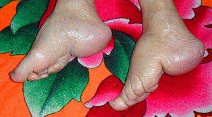 高跟鞋和裹小脚的演变,高跟鞋和古代的裹脚有什么区别