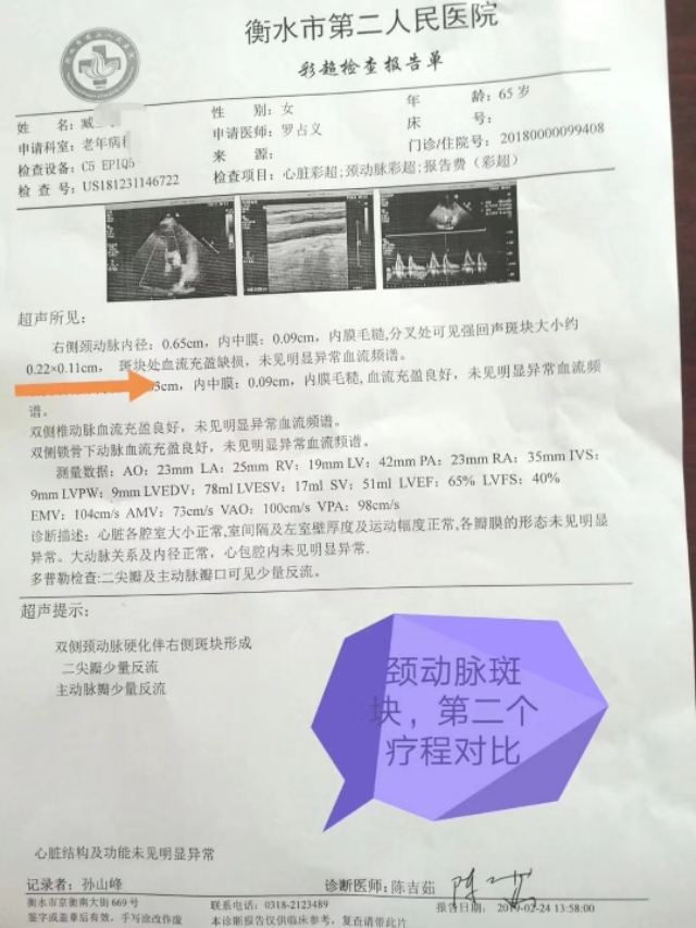 消斑块的秘方,祛血管斑块通络汤