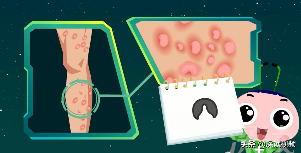 梅毒上热搜，隐私部位出现啥样要警惕？