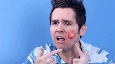 什么精油用了最容易长痘,痘痘上的精油能消除痘痕吗