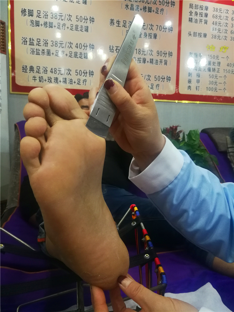 最美修脚师郭丽娟,河南孟津郭丽娟