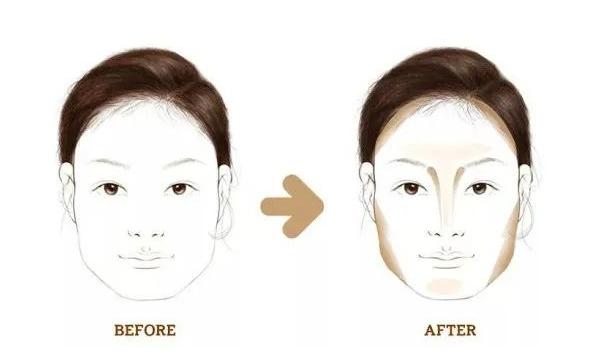 30多岁还能改善下巴后缩吗,30岁还能下颌后缩矫正吗