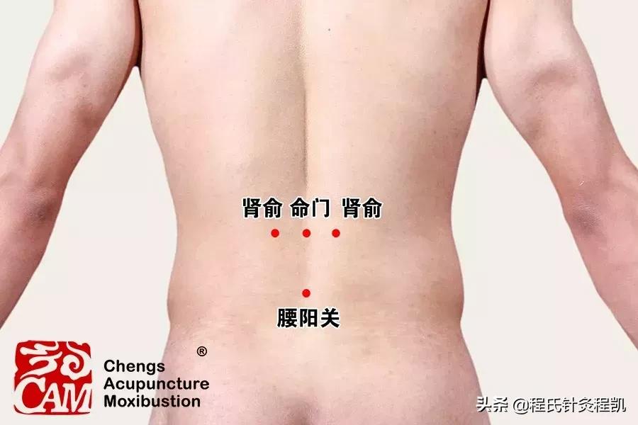 腰痛有寒湿气怎样拔火罐,寒湿腰痛一招解决