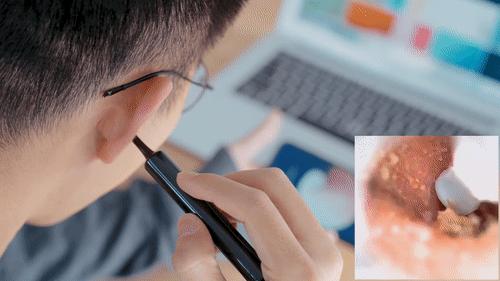 摄像头掏耳勺app,无线高清掏耳勺挖耳神器带摄像头