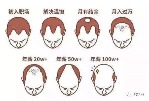 要如何拯救你我的发际线,发际线后移中医