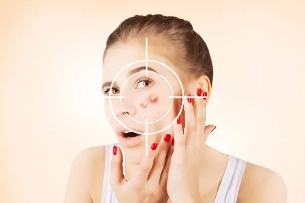 九重天仙女的刷酸祛痘法则（纯干货）