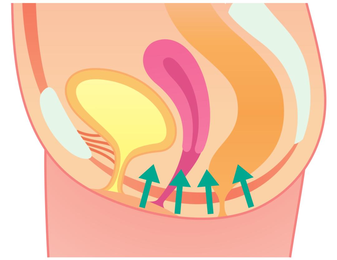 改善盆底肌松弛尿频,改善盆底肌松弛漏尿仪器怎么做