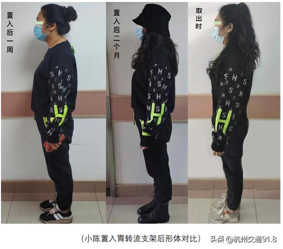 减肥黑科技项目,减肥运动快速燃脂黑科技