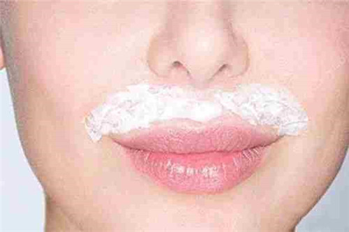 长唇毛的地方黑怎么去除,唇毛怎么遮盖四大方法轻松搞定