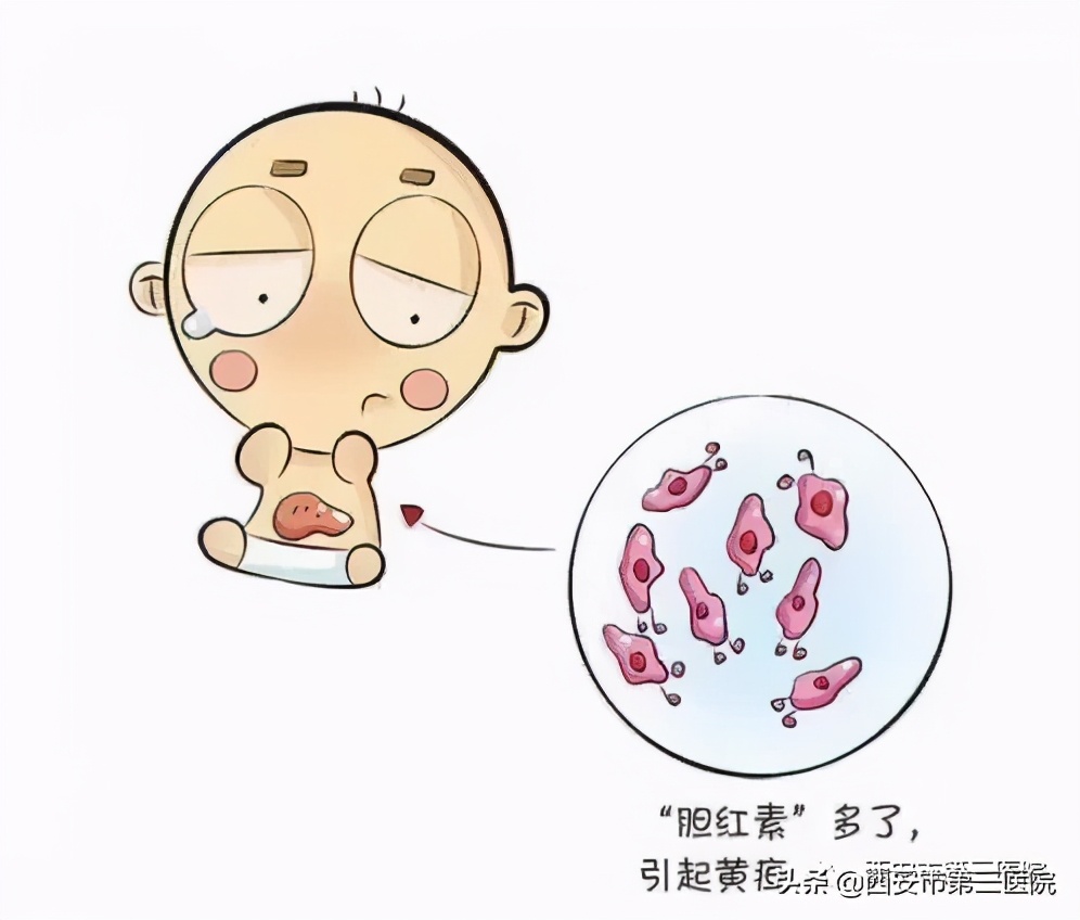 育儿须知宝宝出生有黄疸怎么办,担心宝宝出生有黄疸怎么办