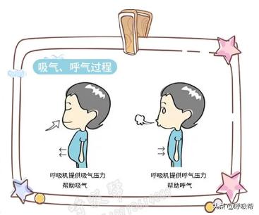 瑞思迈呼吸机型号区别图片,瑞思迈呼吸机型号及价格