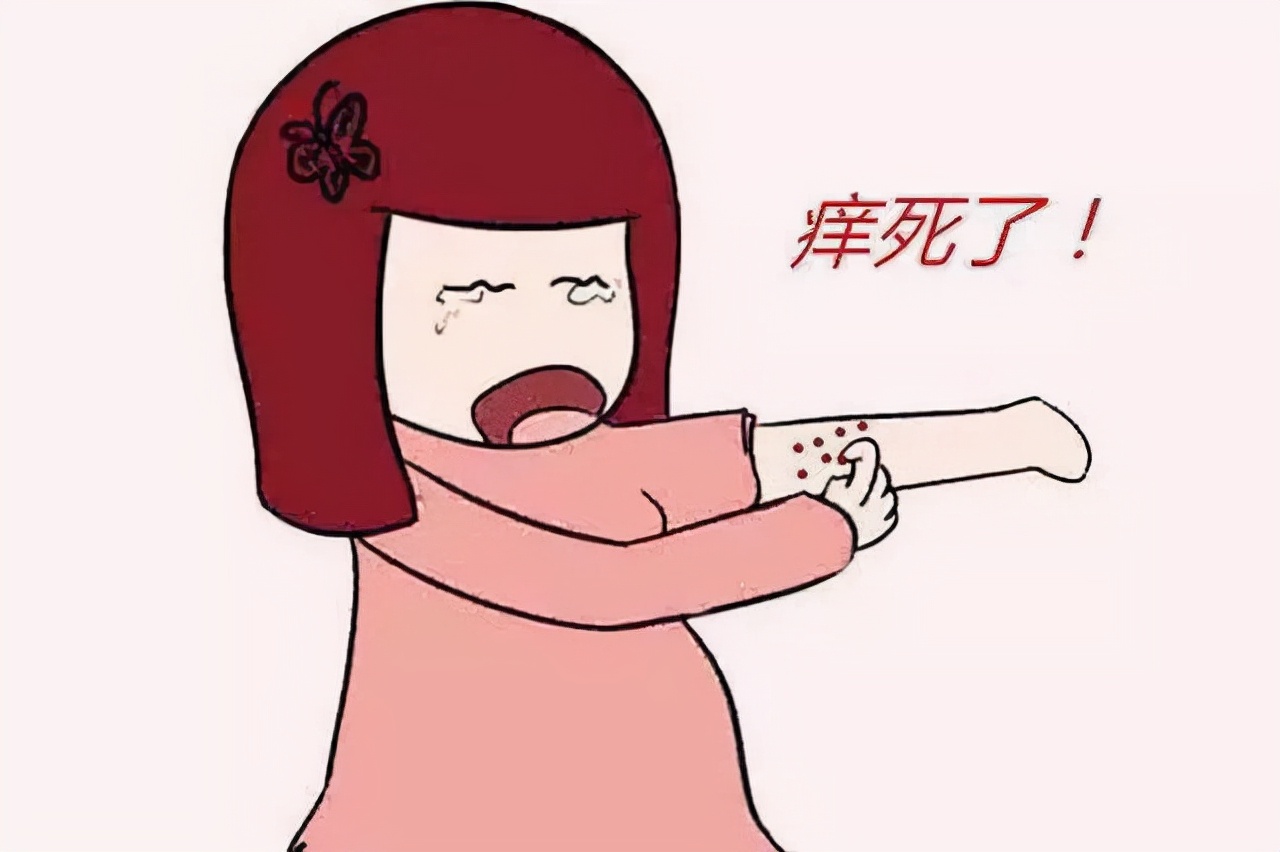 老年皮肤瘙痒特效外用药,治疗皮肤瘙痒的口服药有哪些