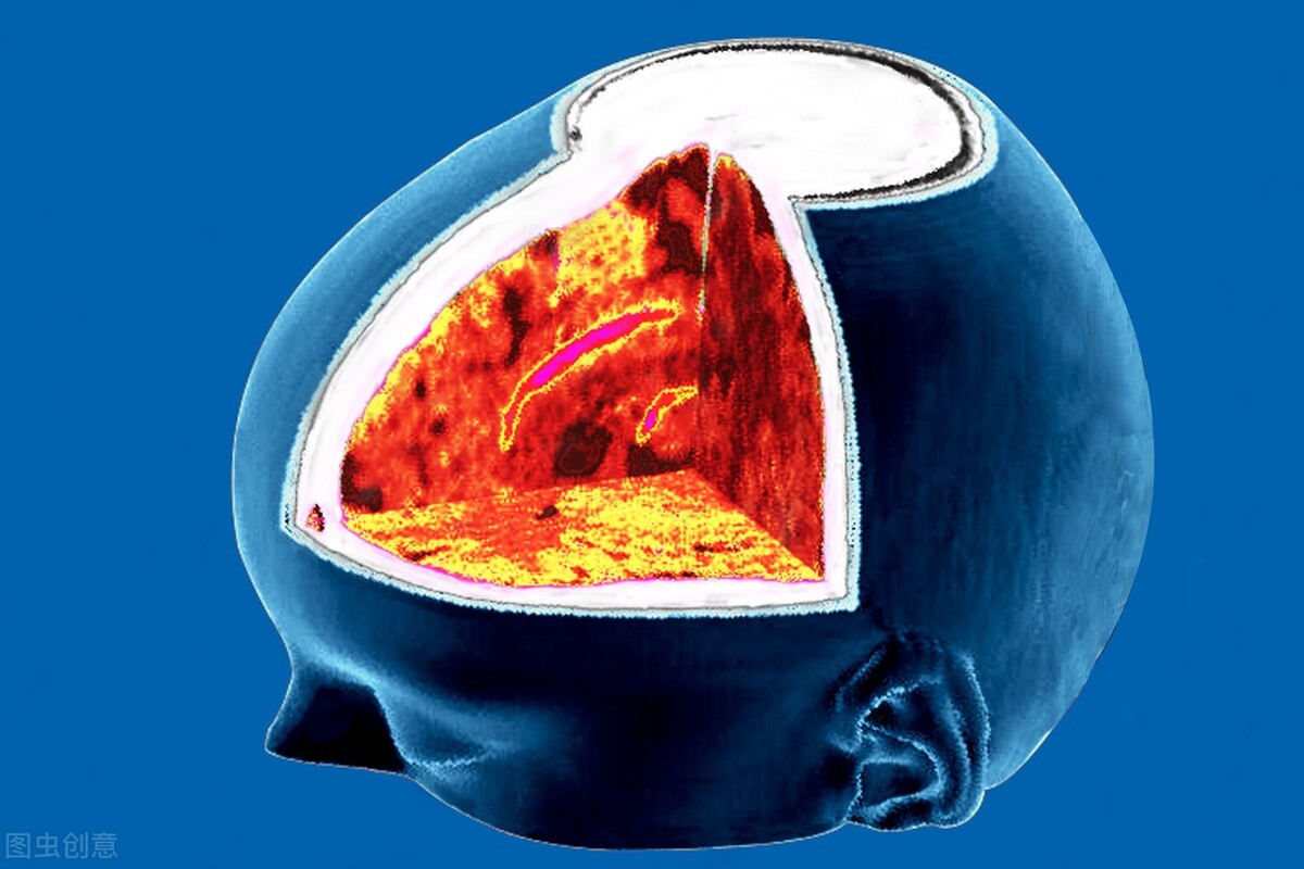 经常头痛但是ct没问题,经常头痛做ct和核磁共振都正常