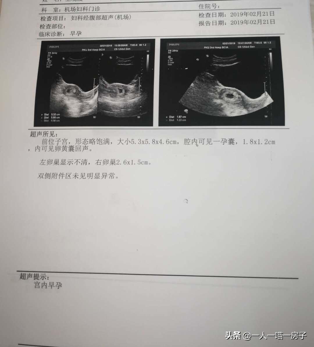 孕期日记:顺利通过无创DNA