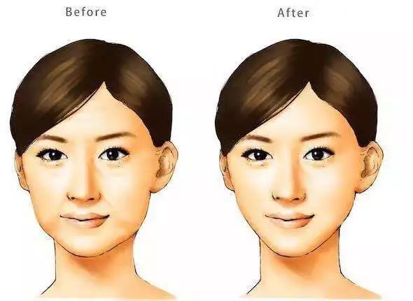 佟丽娅瘦脸前后判若两人不手术不打针如何瘦出一张无皱精致美人脸