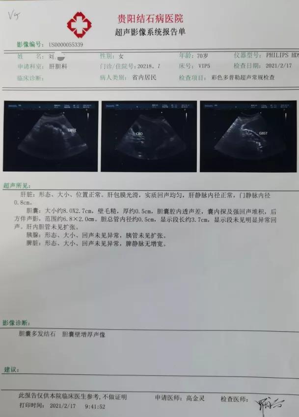 绝不是危言耸听！胆结石腹痛半年不治疗，差点和死神擦肩而过