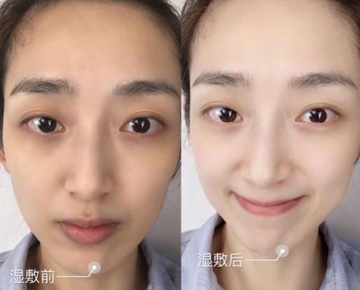 对痘痘闭口有效的精华推荐,闭口粉刺选什么纯露